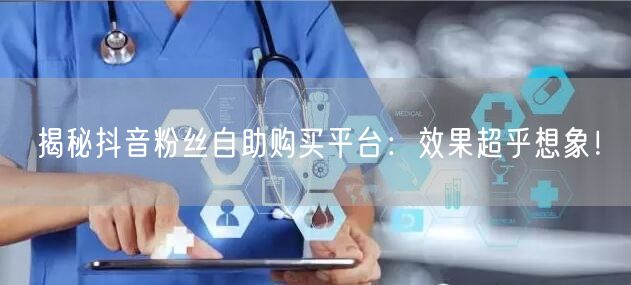 揭秘抖音粉丝自助购买平台：效果超乎想象！